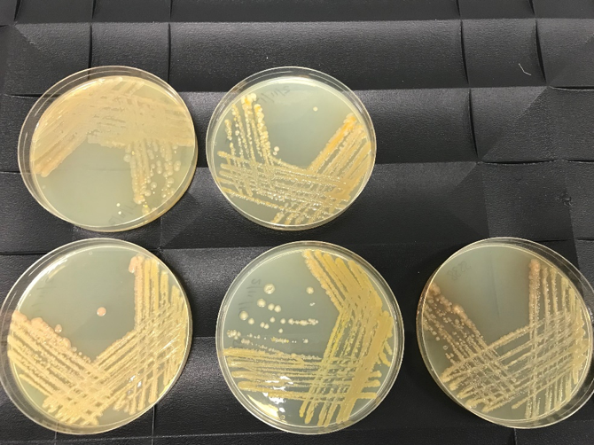 What happens to your swab when it arrives at Adam's lab? LSTM